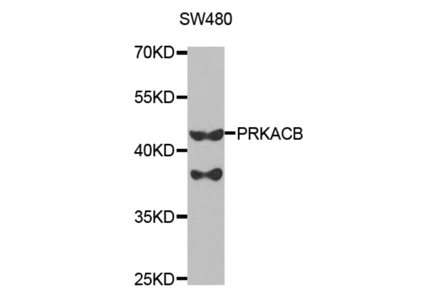Western blot - PRKACB Antibody from Signalway Antibody (32772) - Antibodies.com