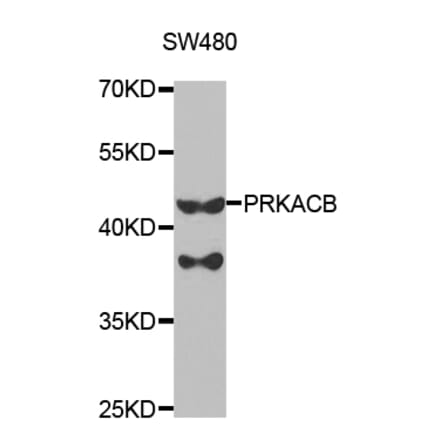 Western blot - PRKACB Antibody from Signalway Antibody (32772) - Antibodies.com