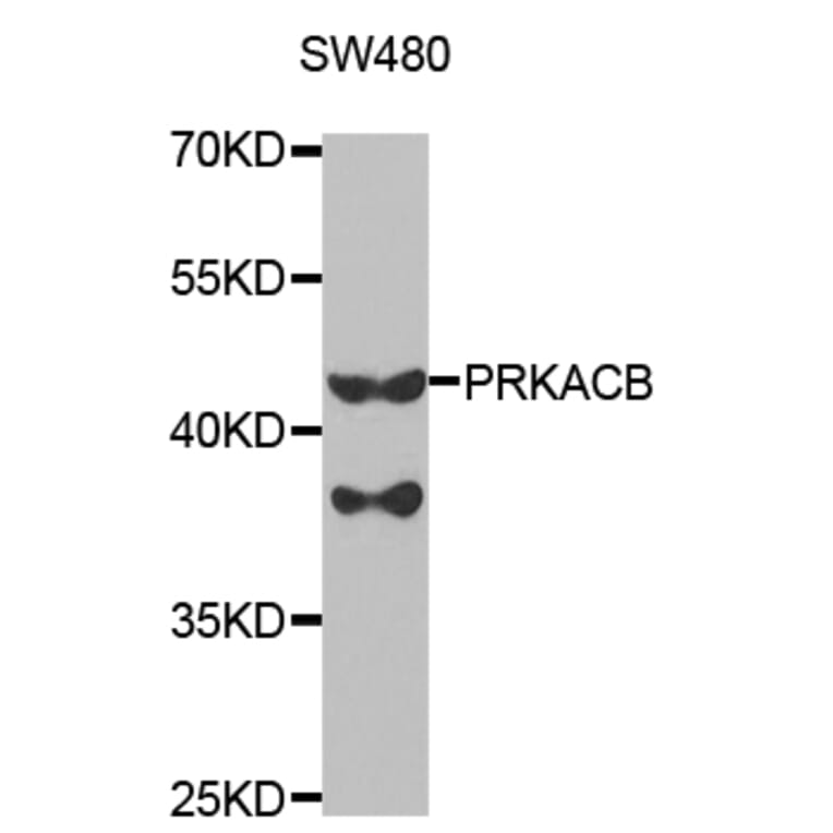 Western blot - PRKACB Antibody from Signalway Antibody (32772) - Antibodies.com