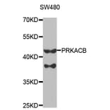 Western blot - PRKACB Antibody from Signalway Antibody (32772) - Antibodies.com