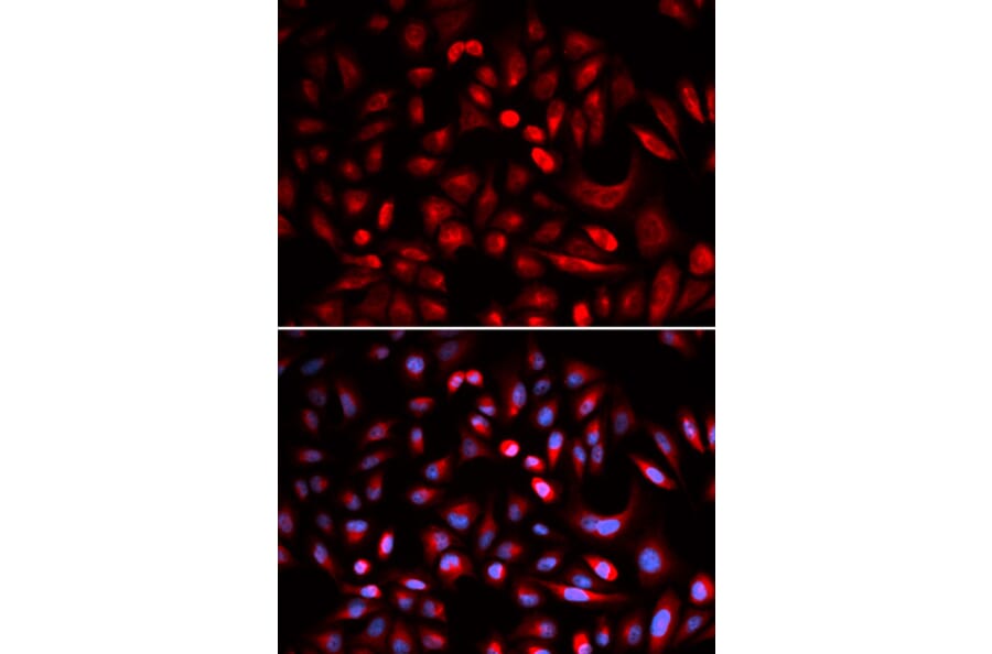 Immunofluorescence - PRKACB Antibody from Signalway Antibody (32772) - Antibodies.com
