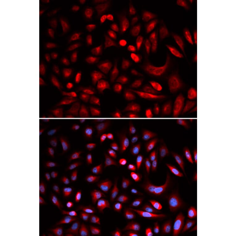 Immunofluorescence - PRKACB Antibody from Signalway Antibody (32772) - Antibodies.com