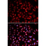 Immunofluorescence - PRKACB Antibody from Signalway Antibody (32772) - Antibodies.com