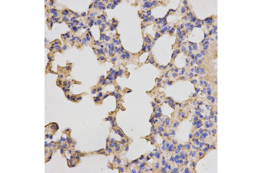 Immunohistochemistry - PRKACB Antibody from Signalway Antibody (32772) - Antibodies.com