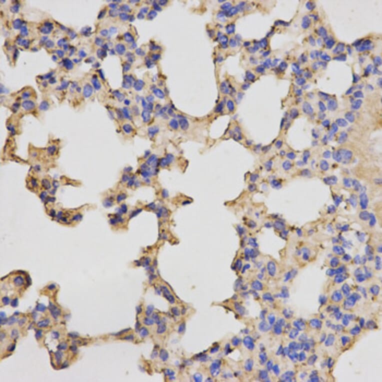 Immunohistochemistry - PRKACB Antibody from Signalway Antibody (32772) - Antibodies.com