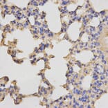 Immunohistochemistry - PRKACB Antibody from Signalway Antibody (32772) - Antibodies.com