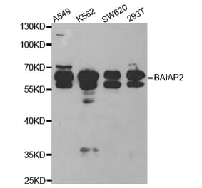 Western blot - BAIAP2 Antibody from Signalway Antibody (32781) - Antibodies.com