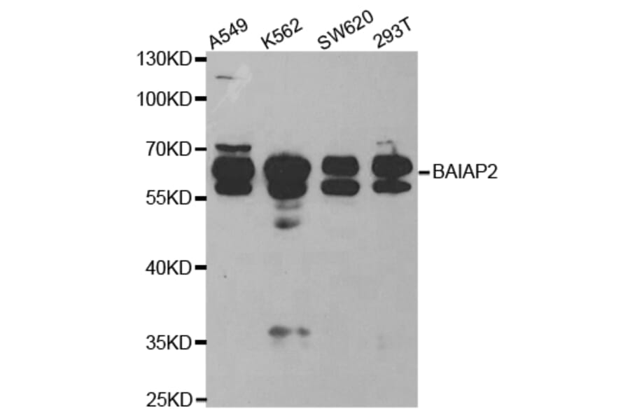 Western blot - BAIAP2 Antibody from Signalway Antibody (32781) - Antibodies.com