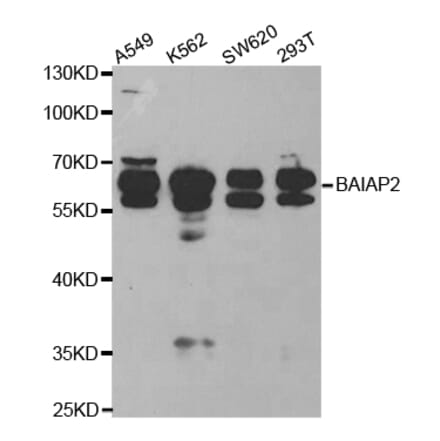 Western blot - BAIAP2 Antibody from Signalway Antibody (32781) - Antibodies.com