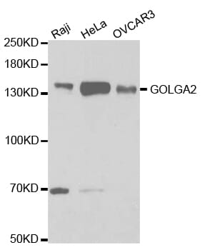 Western blot analysis of extracts of various cell lines, using GOLGA2 antibody.