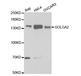 Western blot - GOLGA2 Antibody from Signalway Antibody (32785) - Antibodies.com