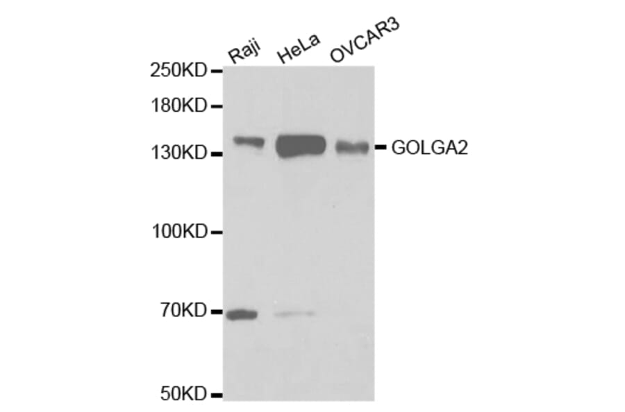 Western blot - GOLGA2 Antibody from Signalway Antibody (32785) - Antibodies.com