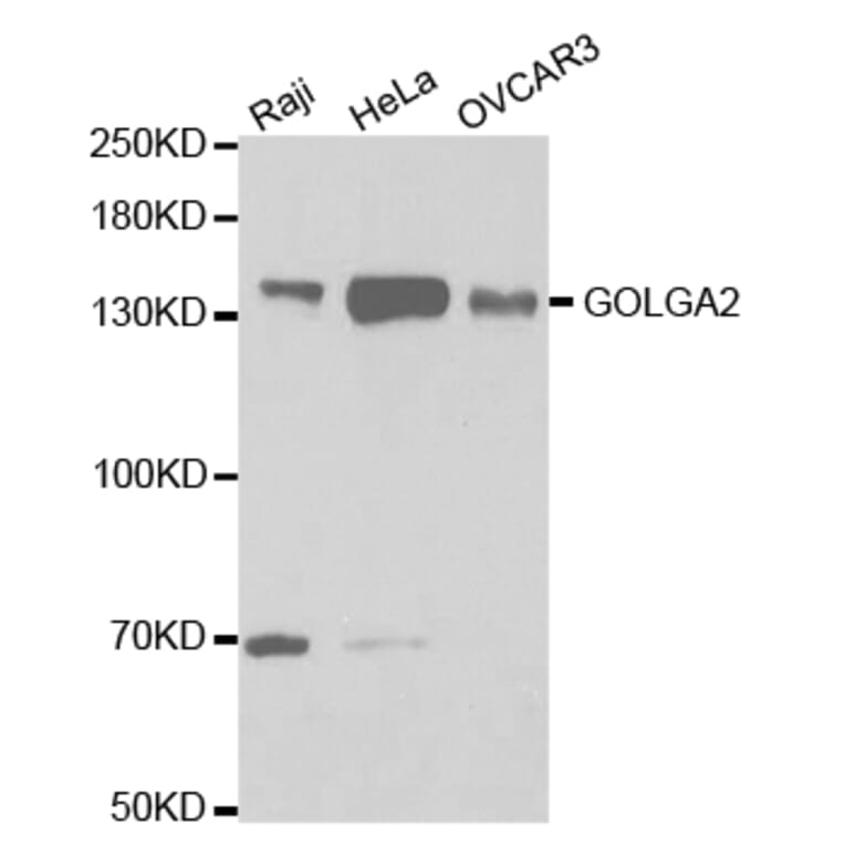 Western blot - GOLGA2 Antibody from Signalway Antibody (32785) - Antibodies.com