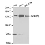 Western blot - GOLGA2 Antibody from Signalway Antibody (32785) - Antibodies.com