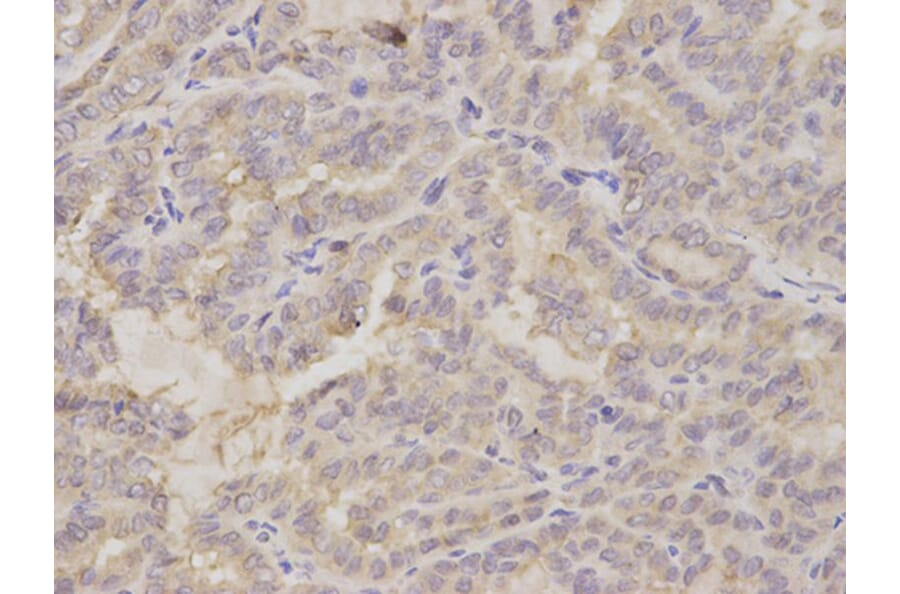 Immunohistochemistry - GOLGA2 Antibody from Signalway Antibody (32785) - Antibodies.com