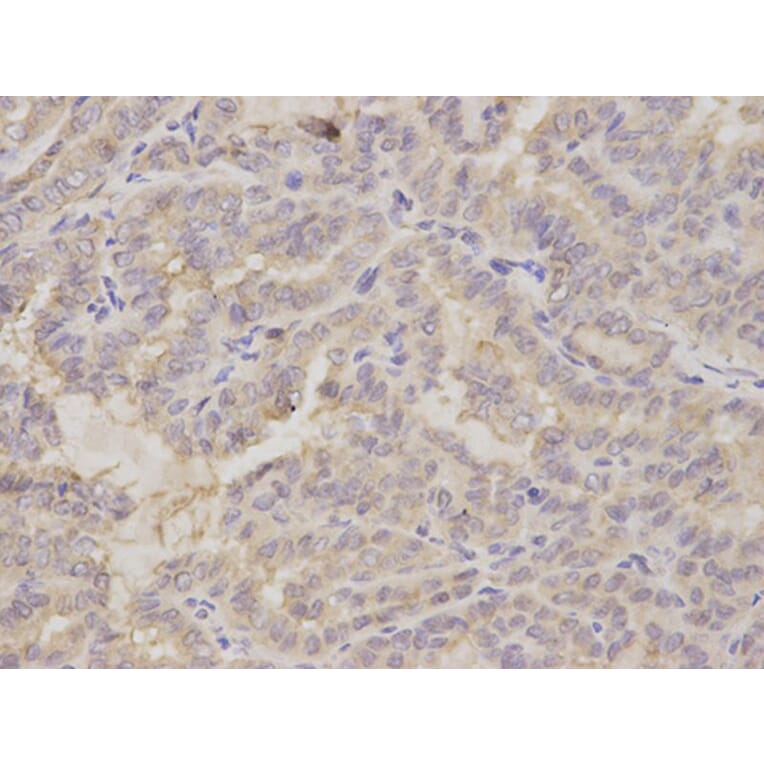 Immunohistochemistry - GOLGA2 Antibody from Signalway Antibody (32785) - Antibodies.com
