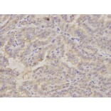 Immunohistochemistry - GOLGA2 Antibody from Signalway Antibody (32785) - Antibodies.com