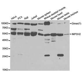 Western blot - IMPDH2 Antibody from Signalway Antibody (32790) - Antibodies.com
