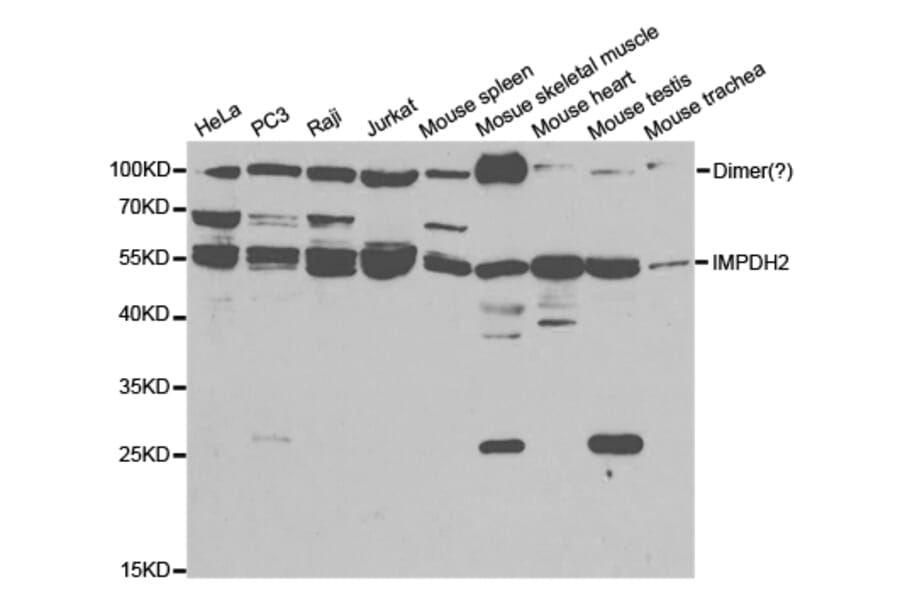 Western blot - IMPDH2 Antibody from Signalway Antibody (32790) - Antibodies.com