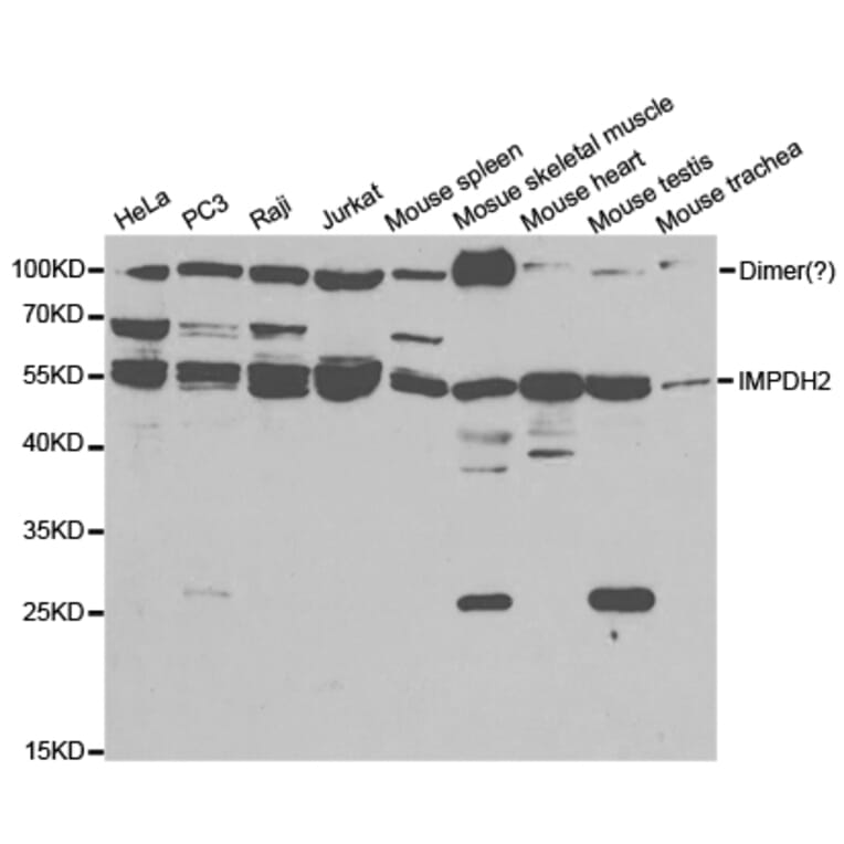 Western blot - IMPDH2 Antibody from Signalway Antibody (32790) - Antibodies.com