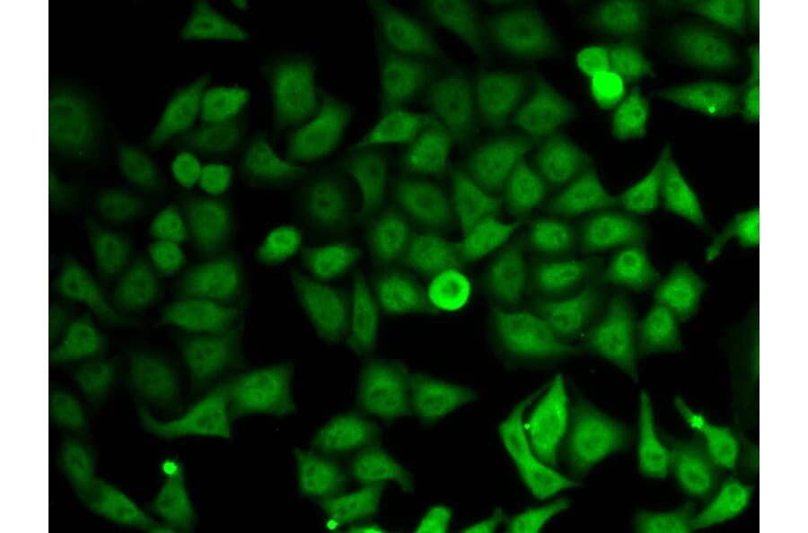 Immunofluorescence - IMPDH2 Antibody from Signalway Antibody (32790) - Antibodies.com