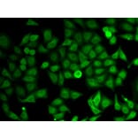 Immunofluorescence - IMPDH2 Antibody from Signalway Antibody (32790) - Antibodies.com