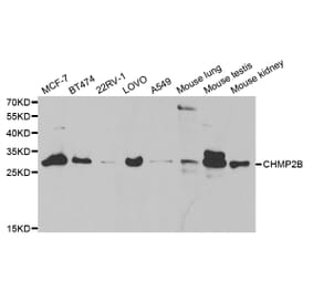 Western blot - CHMP2B Antibody from Signalway Antibody (32829) - Antibodies.com