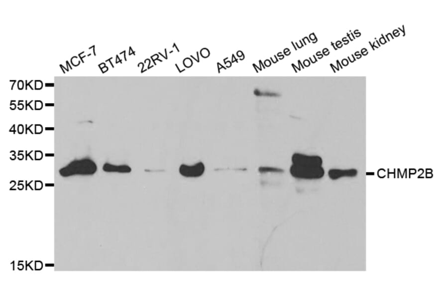 Western blot - CHMP2B Antibody from Signalway Antibody (32829) - Antibodies.com