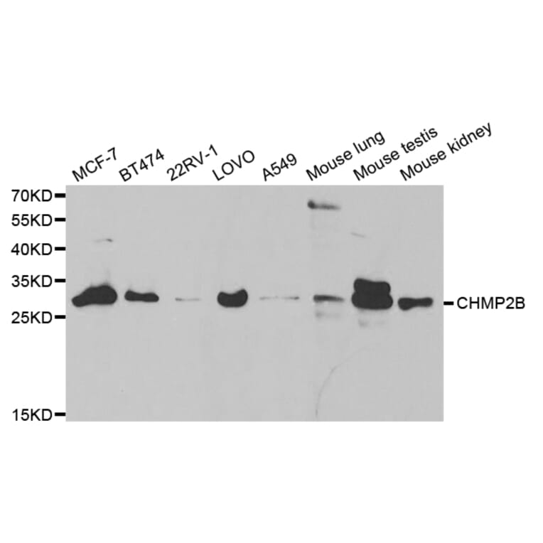 Western blot - CHMP2B Antibody from Signalway Antibody (32829) - Antibodies.com