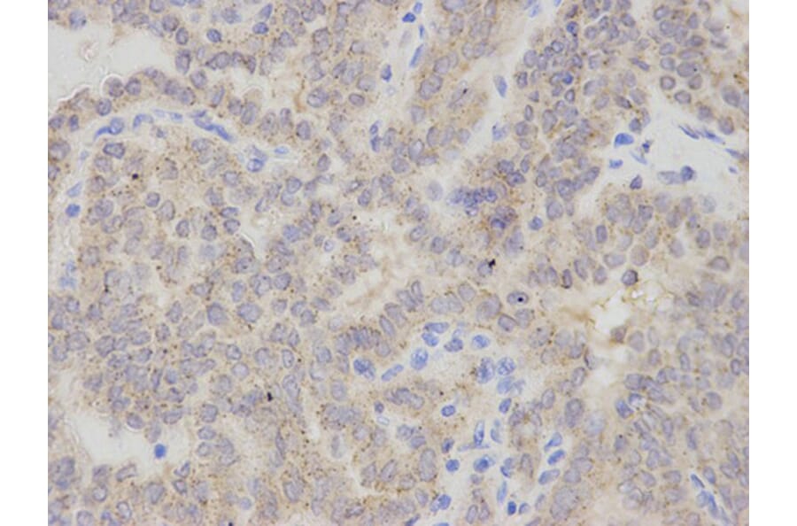 Immunohistochemistry - CHMP2B Antibody from Signalway Antibody (32829) - Antibodies.com