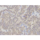 Immunohistochemistry - CHMP2B Antibody from Signalway Antibody (32829) - Antibodies.com