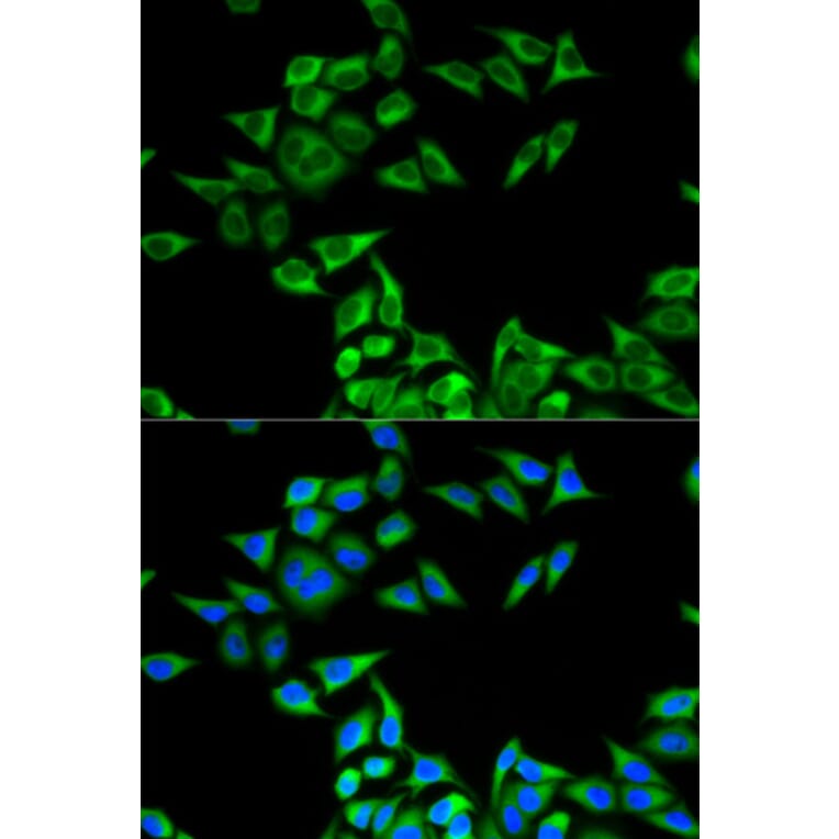 Immunofluorescence - CHMP2B Antibody from Signalway Antibody (32829) - Antibodies.com