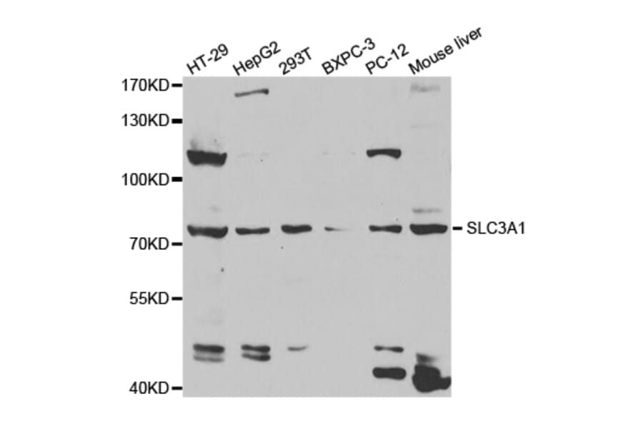Western blot - SLC3A1 Antibody from Signalway Antibody (32890) - Antibodies.com