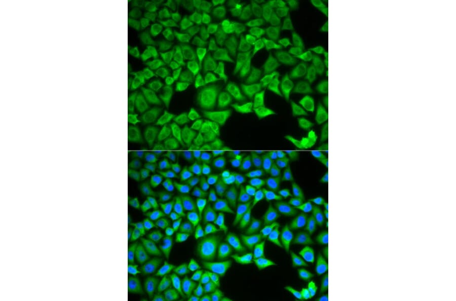 Immunofluorescence - SLC3A1 Antibody from Signalway Antibody (32890) - Antibodies.com