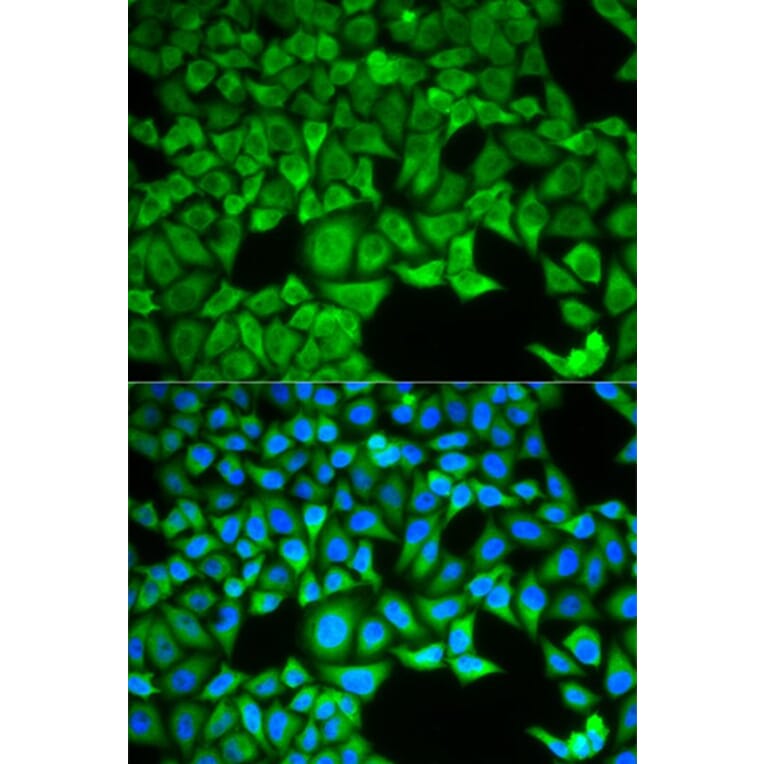 Immunofluorescence - SLC3A1 Antibody from Signalway Antibody (32890) - Antibodies.com