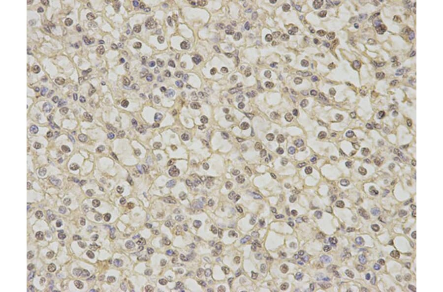 Immunohistochemistry - DNAJB1 Antibody from Signalway Antibody (32894) - Antibodies.com