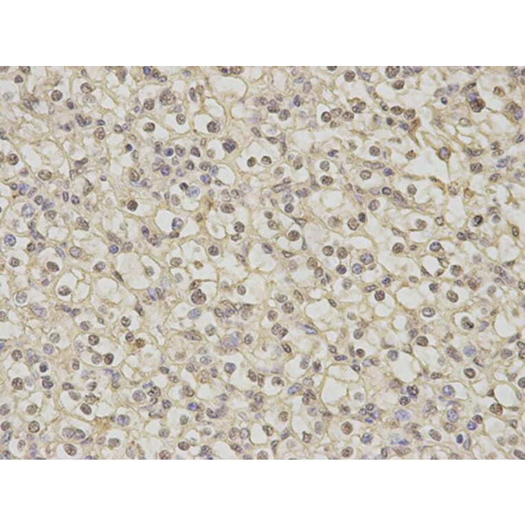 Immunohistochemistry - DNAJB1 Antibody from Signalway Antibody (32894) - Antibodies.com