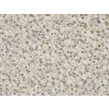 Immunohistochemistry - DNAJB1 Antibody from Signalway Antibody (32894) - Antibodies.com
