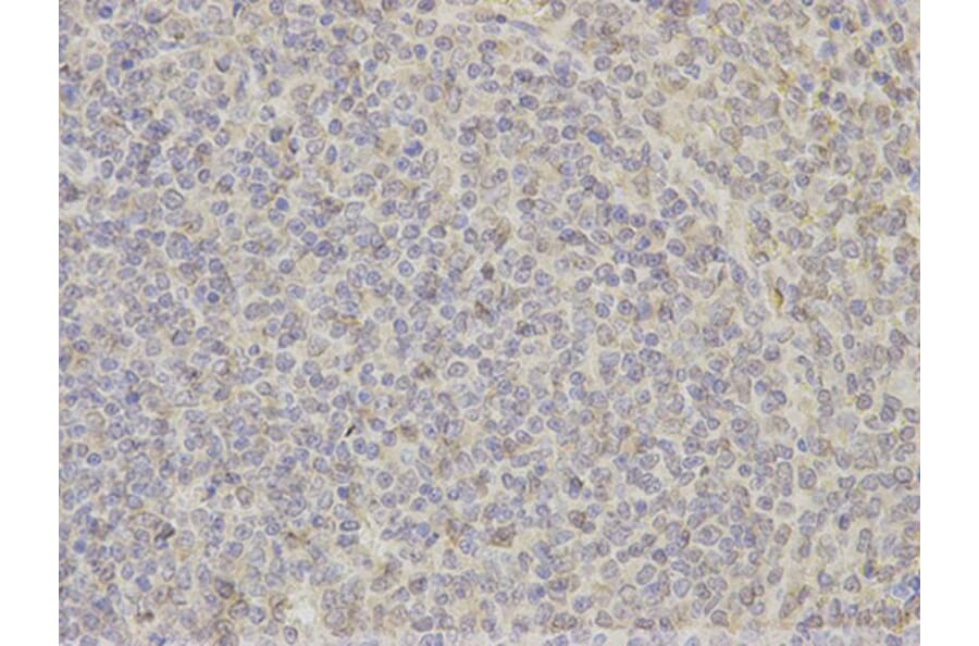 Immunohistochemistry - DNAJB1 Antibody from Signalway Antibody (32894) - Antibodies.com
