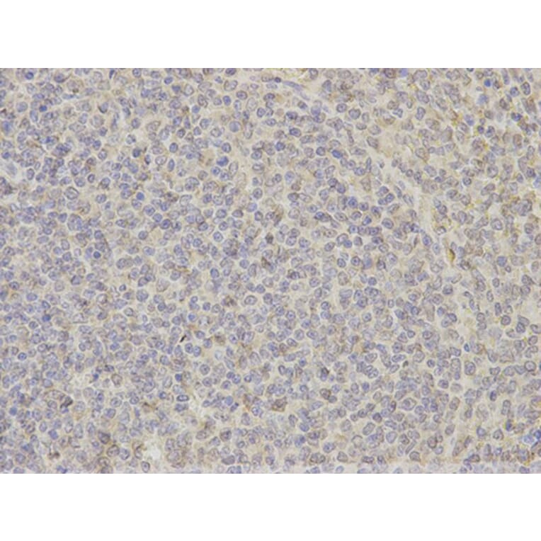 Immunohistochemistry - DNAJB1 Antibody from Signalway Antibody (32894) - Antibodies.com