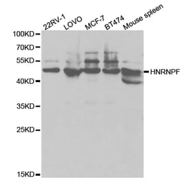 Western blot - HNRNPF Antibody from Signalway Antibody (32895) - Antibodies.com