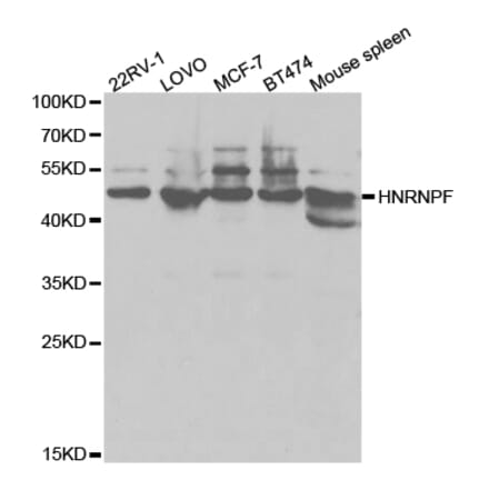 Western blot - HNRNPF Antibody from Signalway Antibody (32895) - Antibodies.com