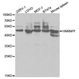Western blot - HNRNPF Antibody from Signalway Antibody (32895) - Antibodies.com