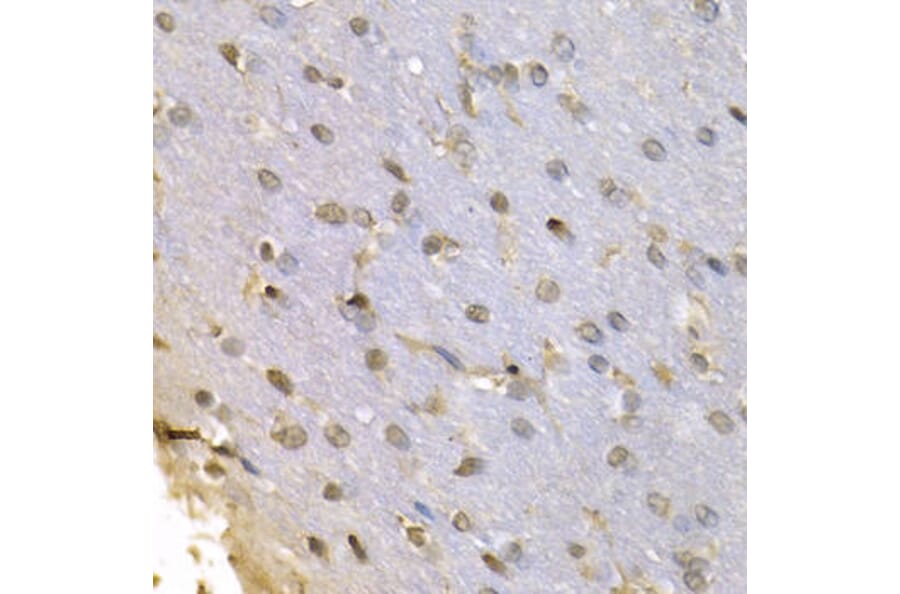 Immunohistochemistry - HNRNPF Antibody from Signalway Antibody (32895) - Antibodies.com