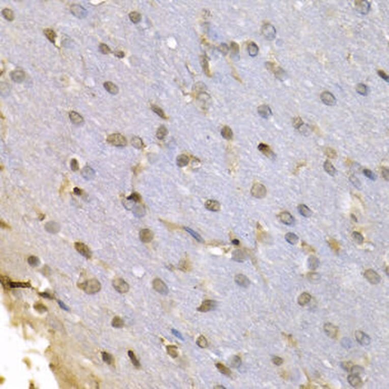 Immunohistochemistry - HNRNPF Antibody from Signalway Antibody (32895) - Antibodies.com