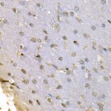 Immunohistochemistry - HNRNPF Antibody from Signalway Antibody (32895) - Antibodies.com