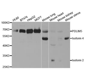 Western blot - PDLIM5 Antibody from Signalway Antibody (32992) - Antibodies.com