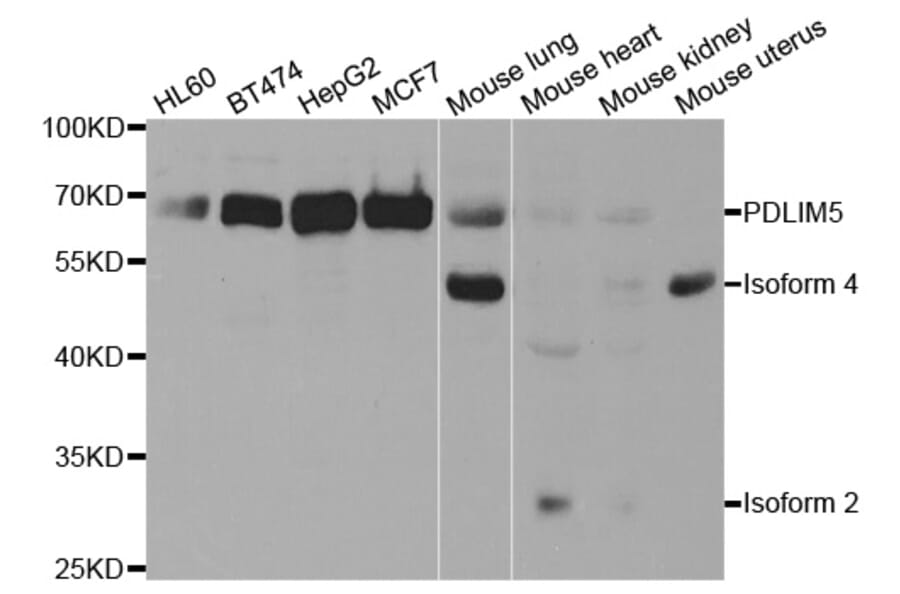 Western blot - PDLIM5 Antibody from Signalway Antibody (32992) - Antibodies.com