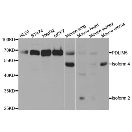 Western blot - PDLIM5 Antibody from Signalway Antibody (32992) - Antibodies.com