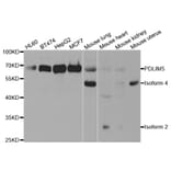 Western blot - PDLIM5 Antibody from Signalway Antibody (32992) - Antibodies.com